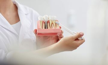 Zahnärztin erklärt Implantat